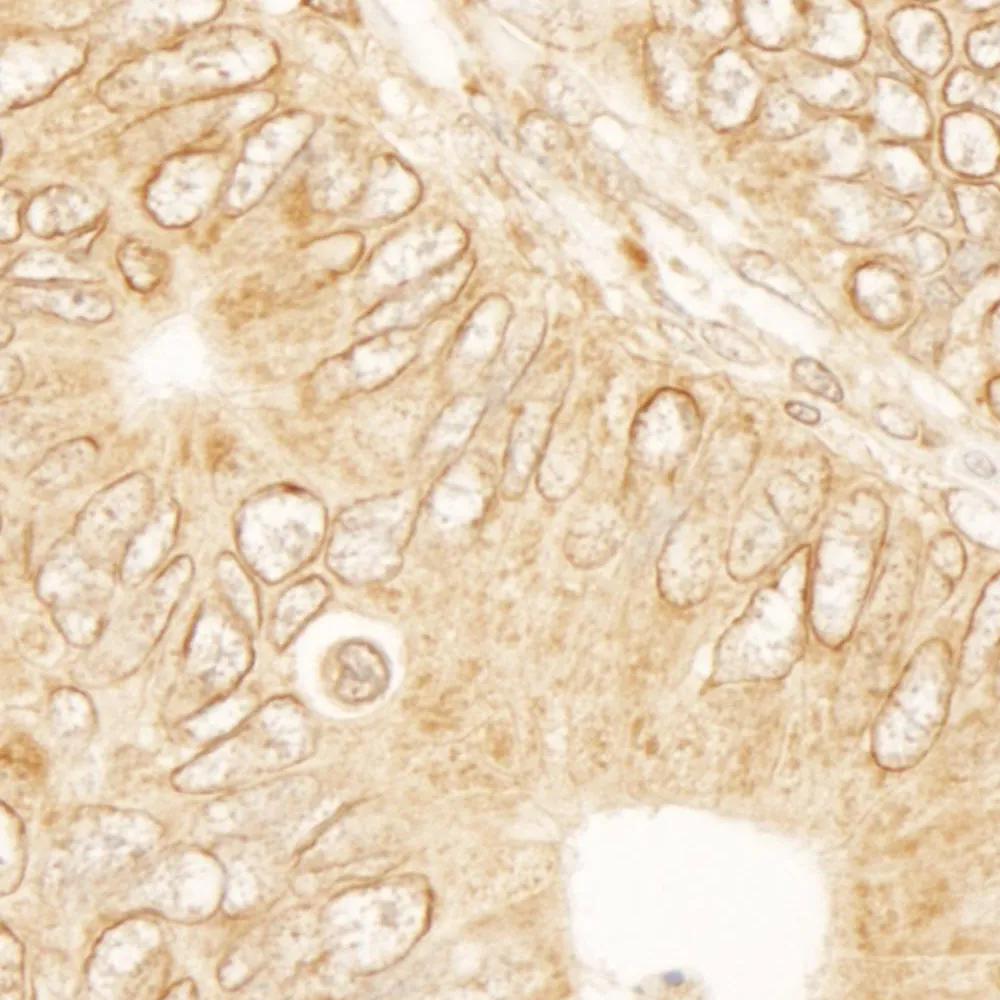 Rabbit anti-RanGAP1 IHC Antibody, Affinity Purified