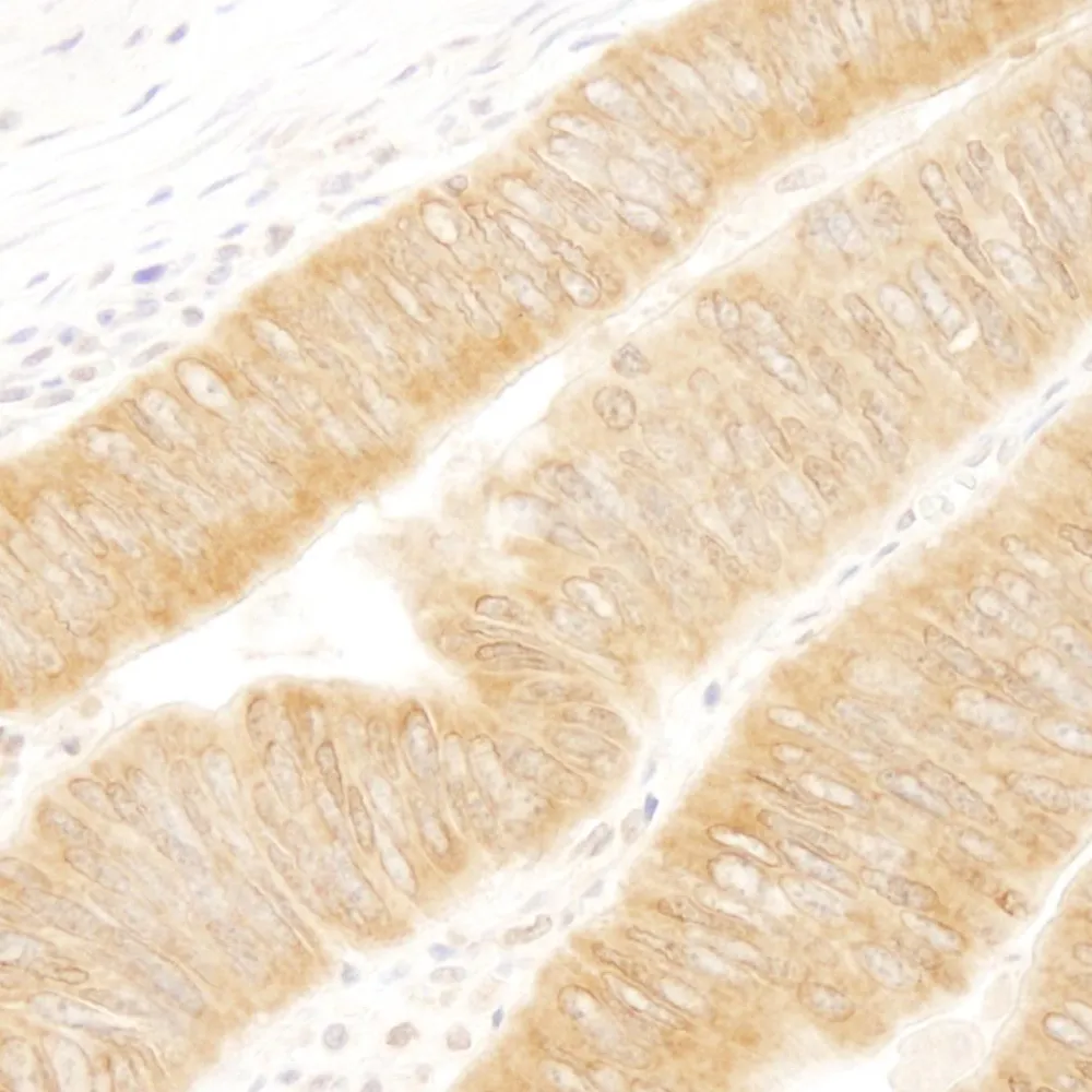 Rabbit anti-UVRAG IHC Antibody, Affinity Purified