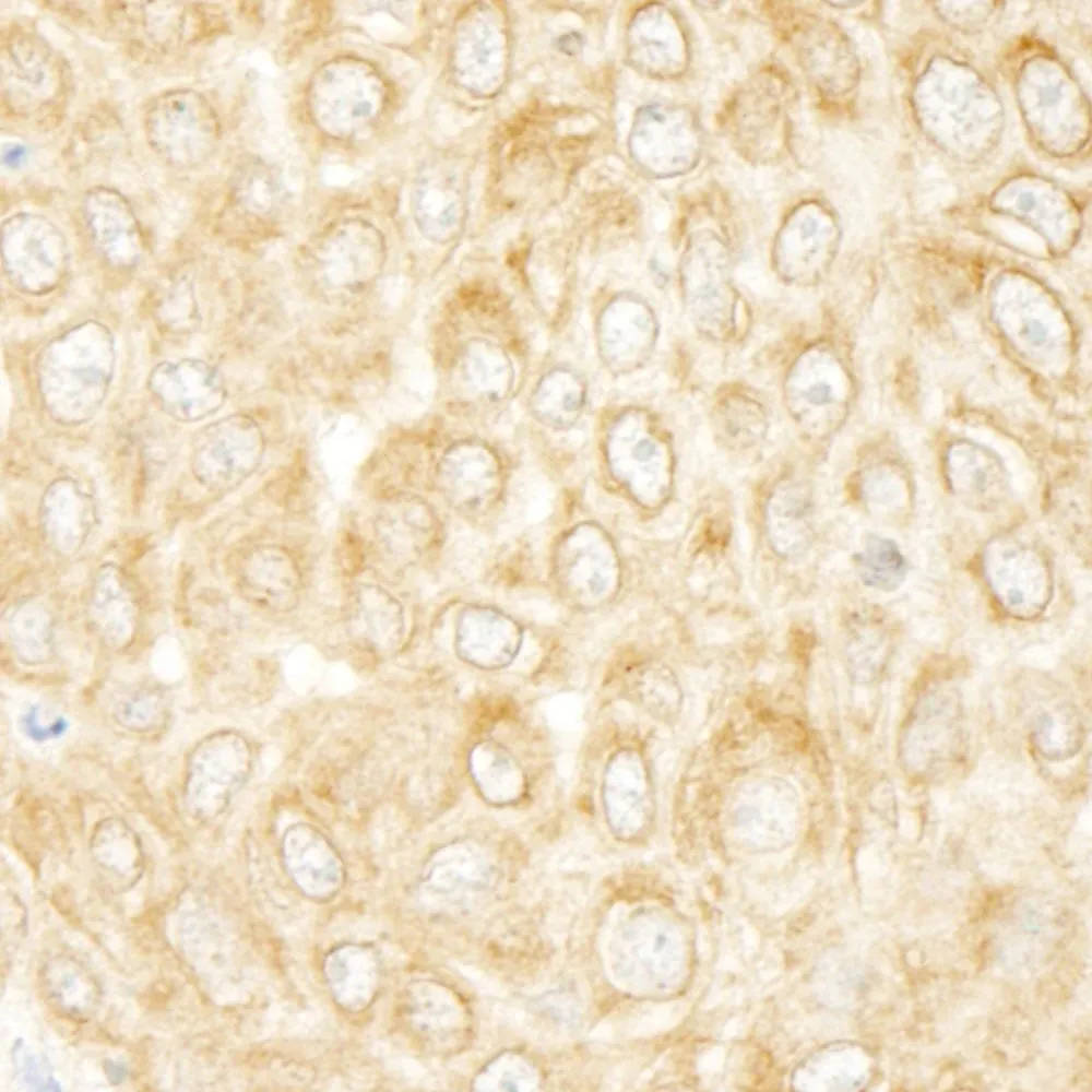 Rabbit anti-ZAK IHC Antibody, Affinity Purified
