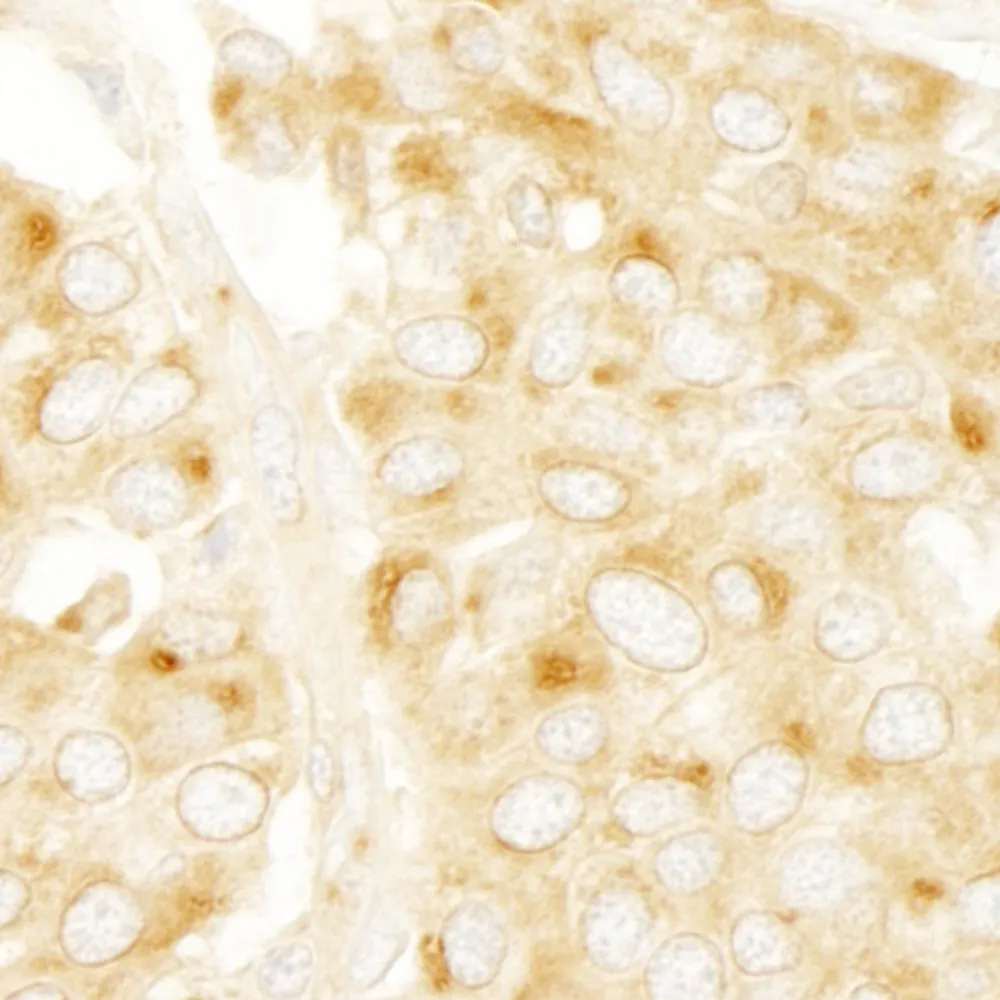 Rabbit anti-PRKAR2A/PKA-RIIalpha IHC Antibody, Affinity Purified