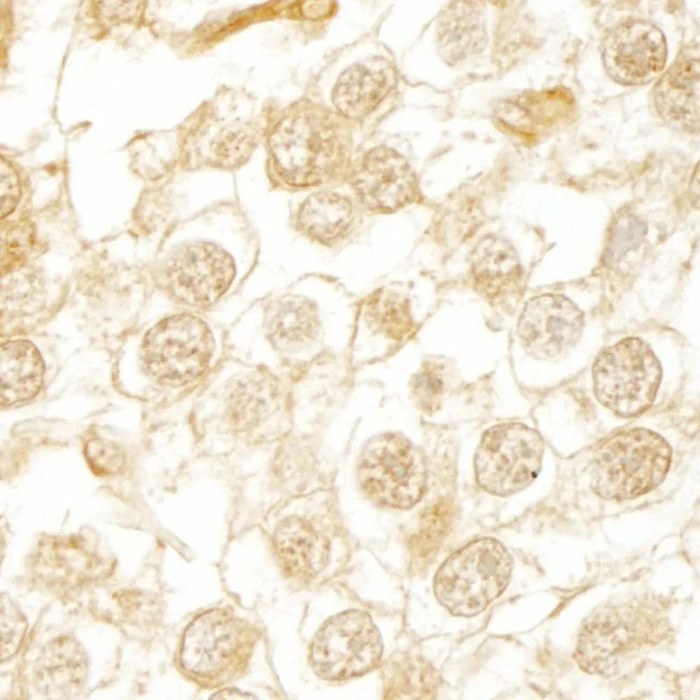 Rabbit anti-WDR20 IHC Antibody, Affinity Purified