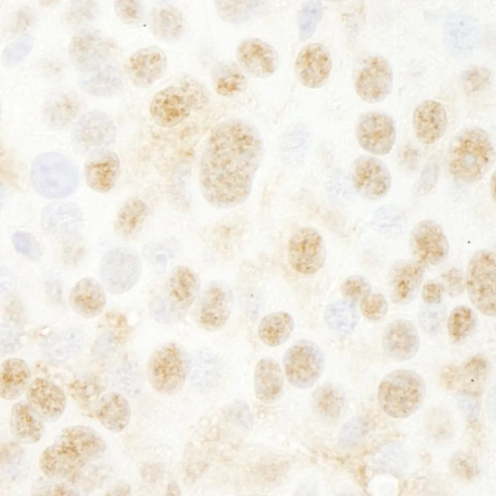Rabbit anti-BMI1 IHC Antibody, Affinity Purified