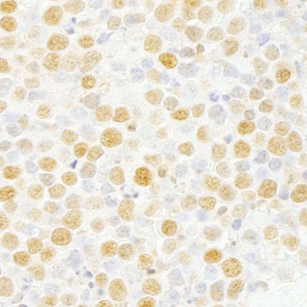 Rabbit anti-ZNF198 IHC Antibody, Affinity Purified