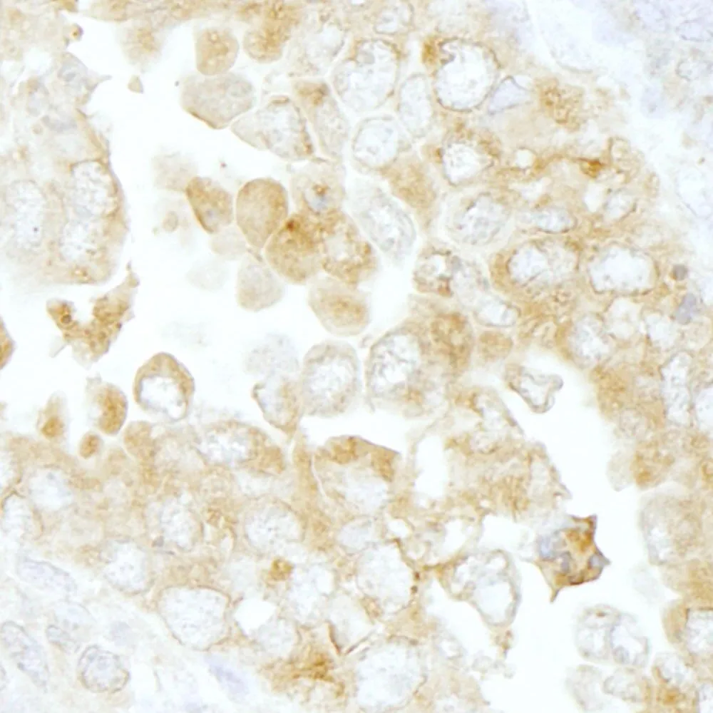 Rabbit anti-Cdc42GAP IHC Antibody, Affinity Purified
