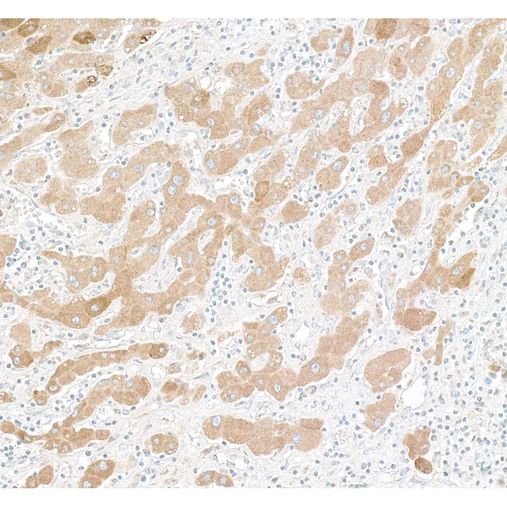 Goat anti-Human C-Reactive Protein (CRP) IHC Antibody, Affinity Purified