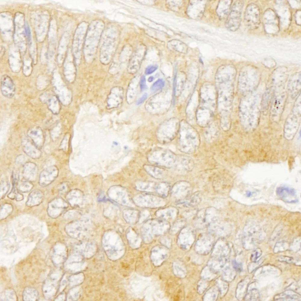 Rabbit anti-GRB10 IHC Antibody, Affinity Purified