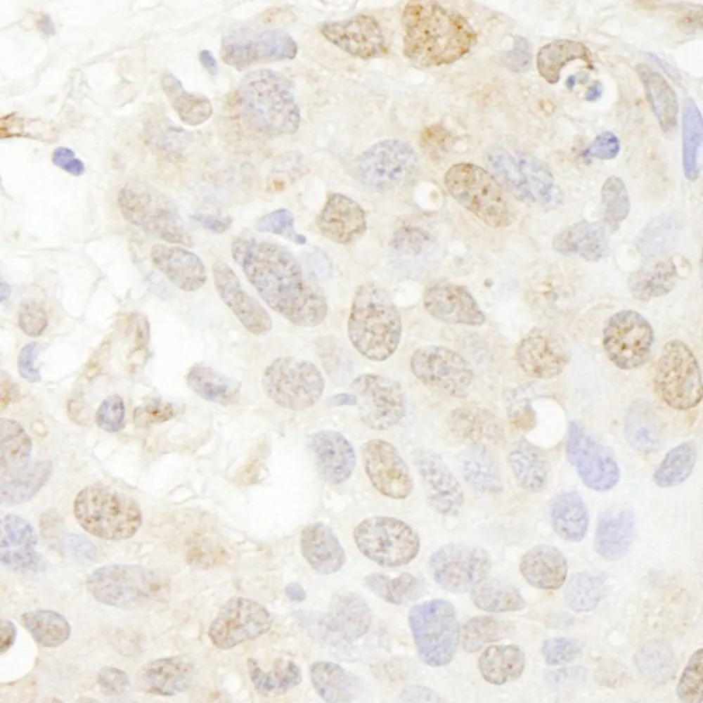 Rabbit anti-SET7 IHC Antibody, Affinity Purified