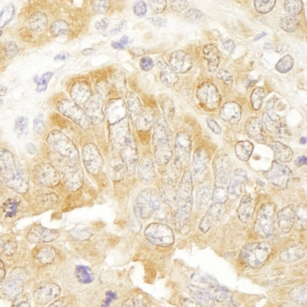 Rabbit anti-eIF3J/EIF3S1 IHC Antibody, Affinity Purified