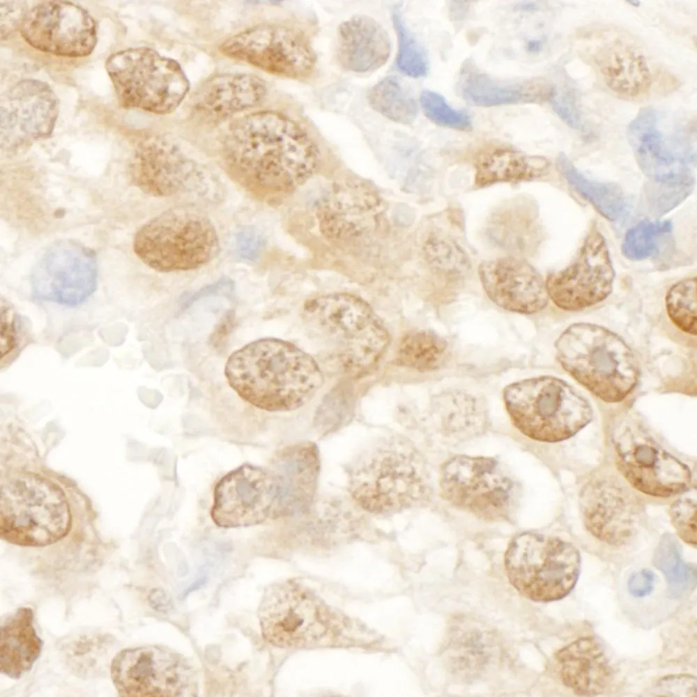 Rabbit anti-NARG1 IHC Antibody, Affinity Purified