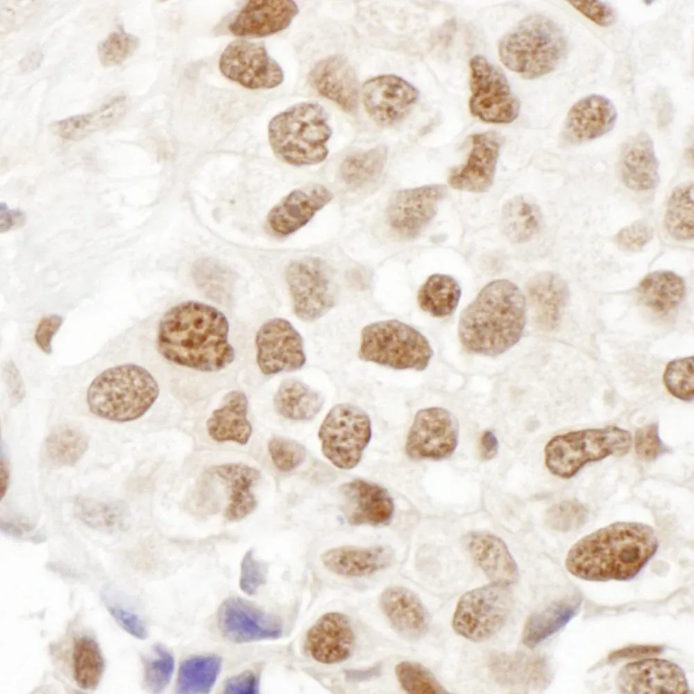 Rabbit anti-FANCD2 IHC Antibody, Affinity Purified