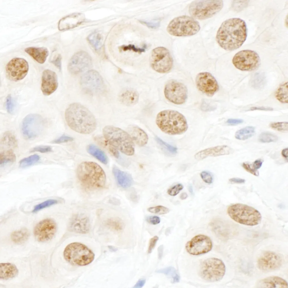 Rabbit anti-TOPORS IHC Antibody, Affinity Purified