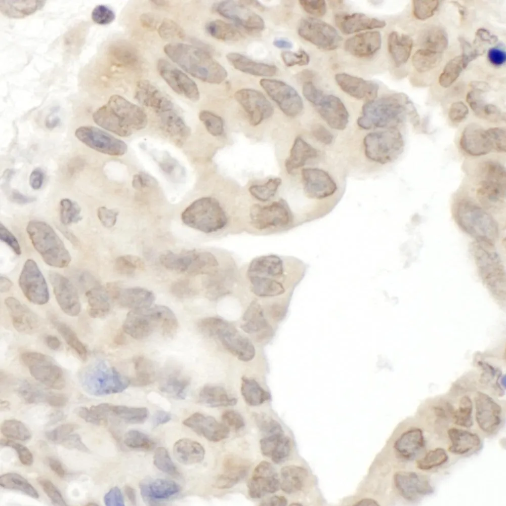 Rabbit anti-JAK2 IHC Antibody, Affinity Purified