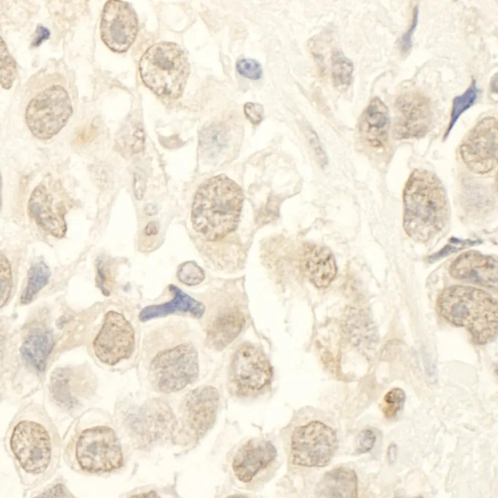 Rabbit anti-HBO IHC Antibody, Affinity Purified