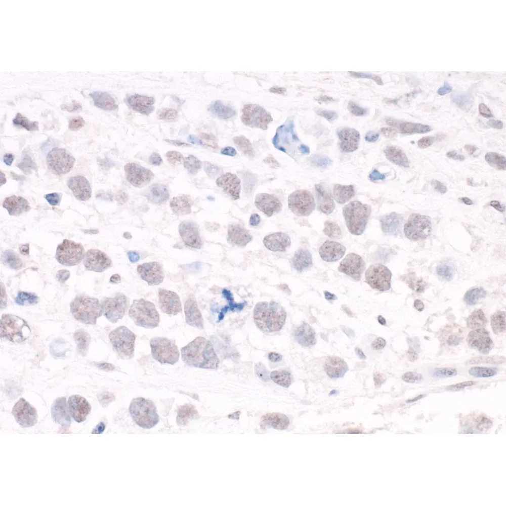 Rabbit anti-ARID2 IHC Antibody, Affinity Purified