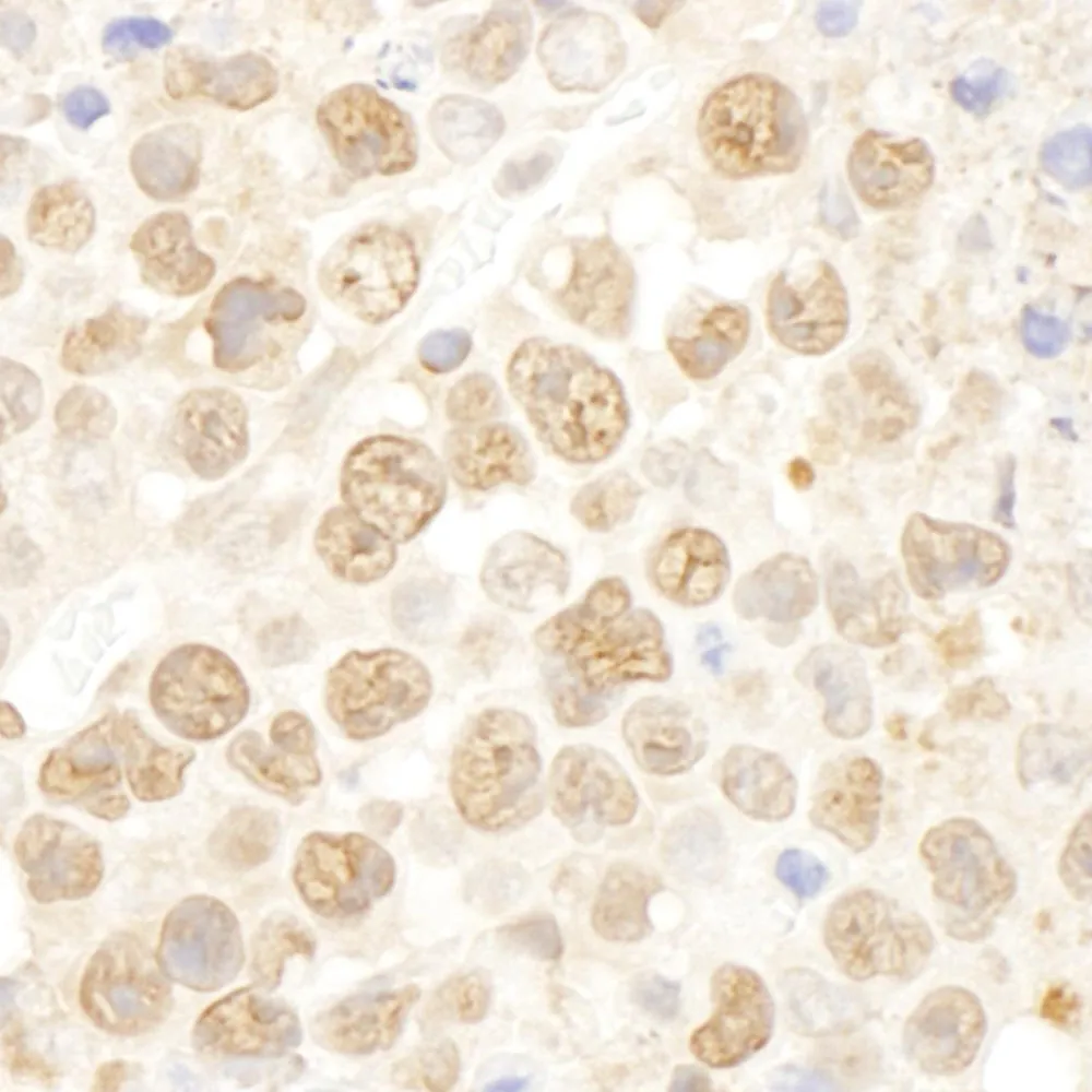 Rabbit anti-DDX27 IHC Antibody, Affinity Purified