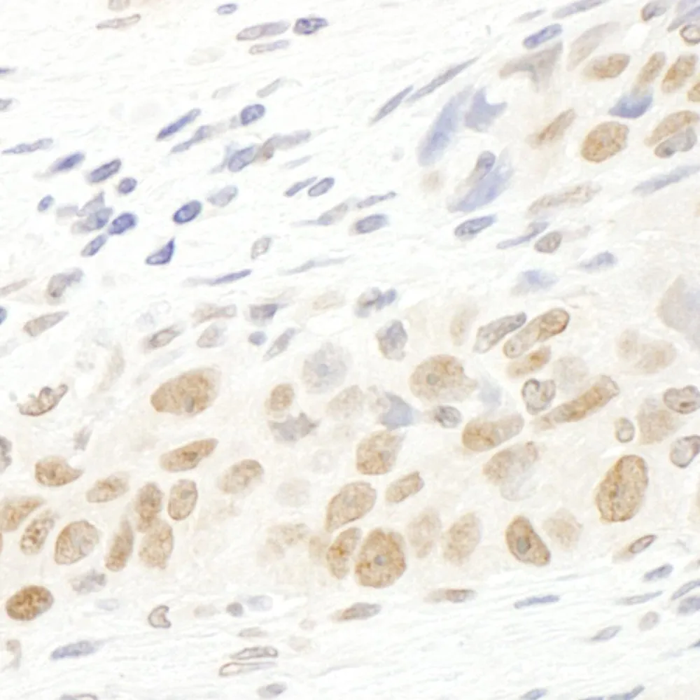 Rabbit anti-MASTL IHC Antibody, Affinity Purified