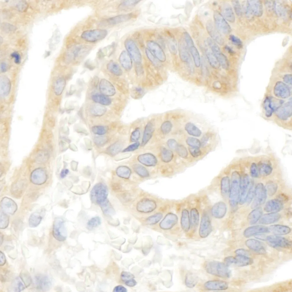Rabbit anti-IP3R3 IHC Antibody, Affinity Purified