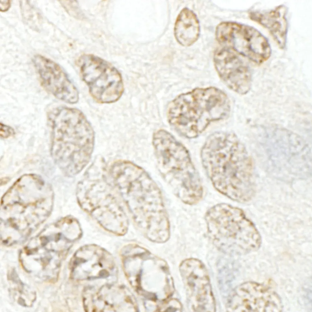 Rabbit anti-hSET1B IHC Antibody, Affinity Purified