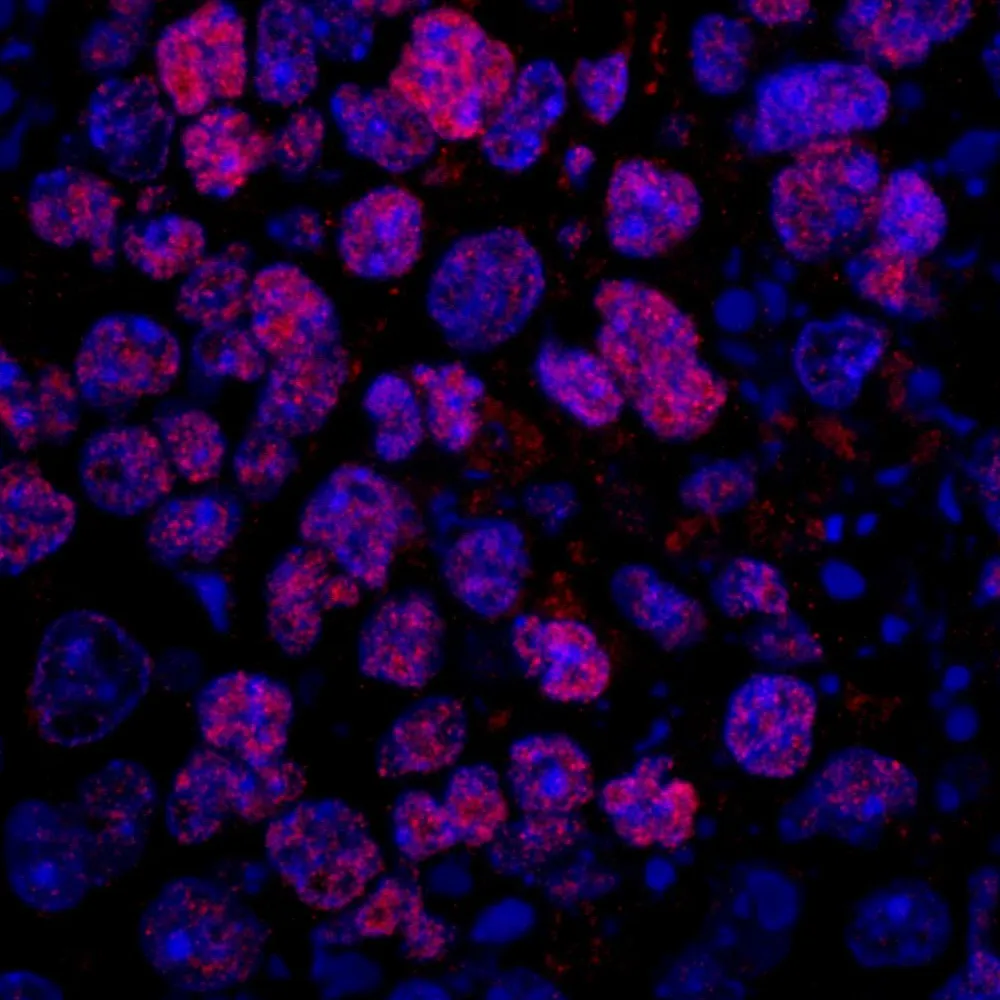 Rabbit anti-FUSIP1 IHC Antibody, Affinity Purified