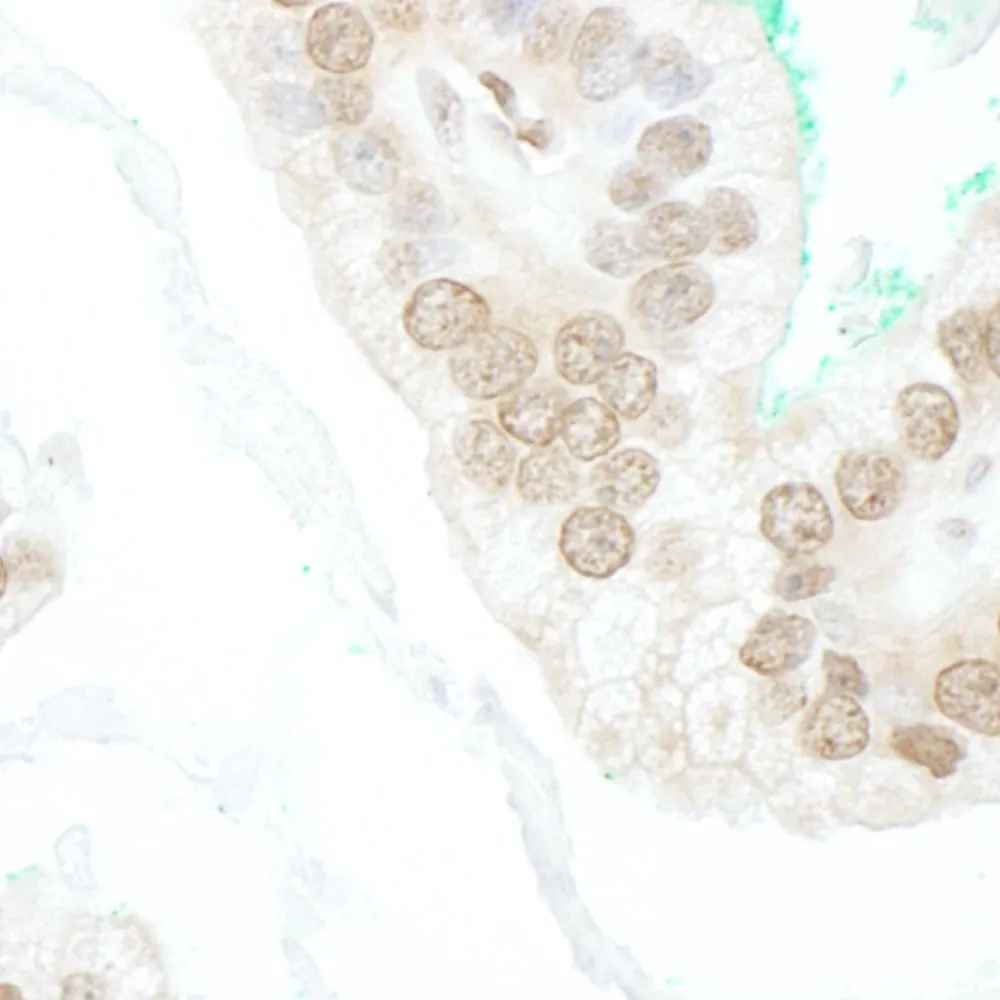 Rabbit anti-BTBD12 IHC Antibody, Affinity Purified