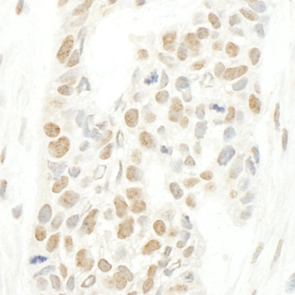 Rabbit anti-CAP-H2 IHC Antibody, Affinity Purified