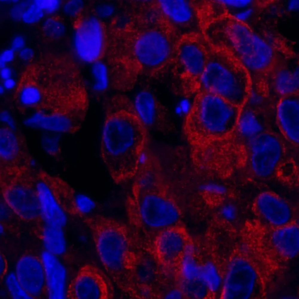 Rabbit anti-SASH1 IHC Antibody, Affinity Purified
