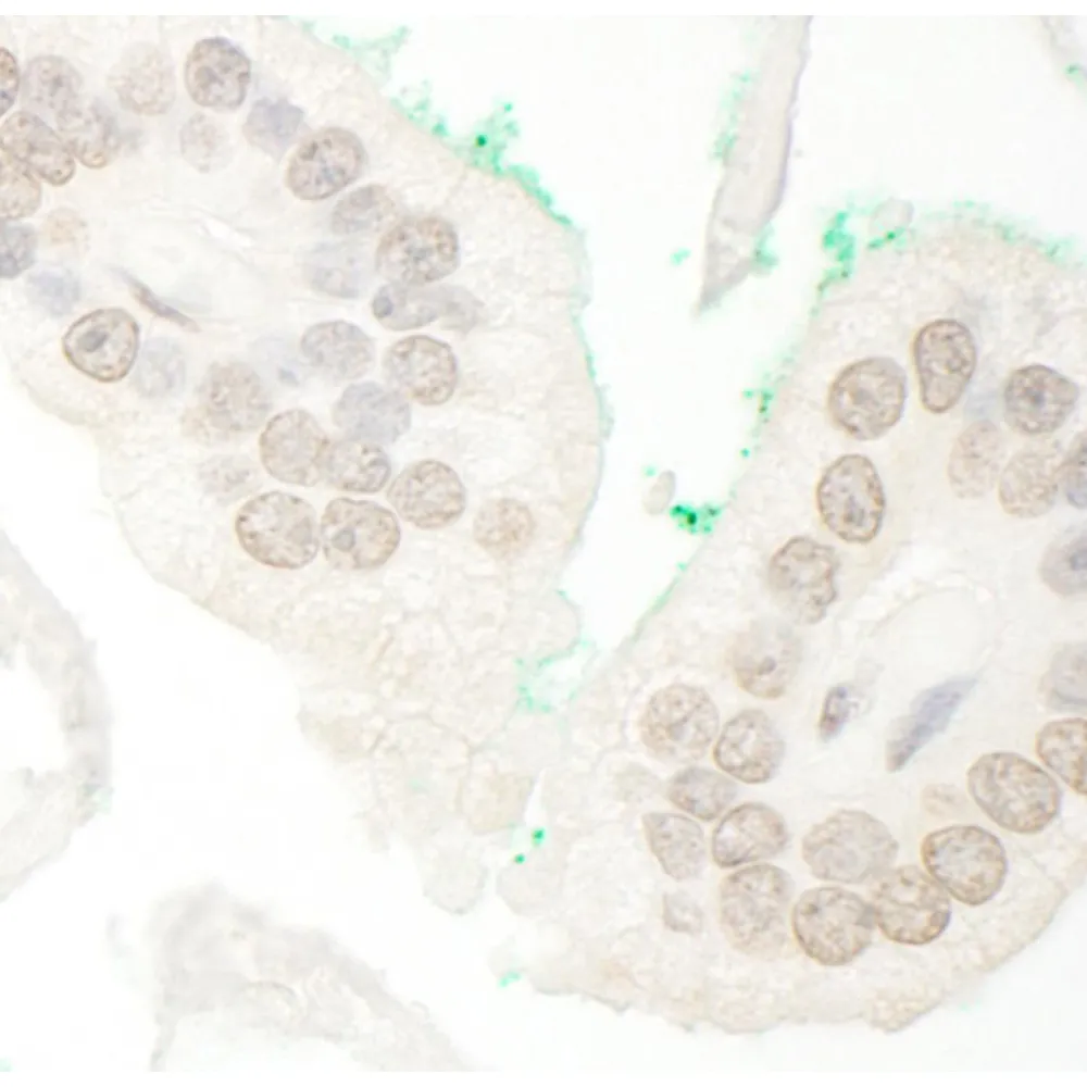 Rabbit anti-ARA70 IHC Antibody, Affinity Purified