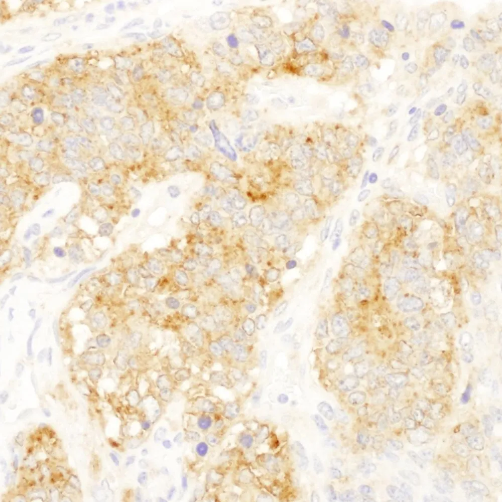 Rabbit anti-eIF3B/EIF3S9 IHC Antibody, Affinity Purified