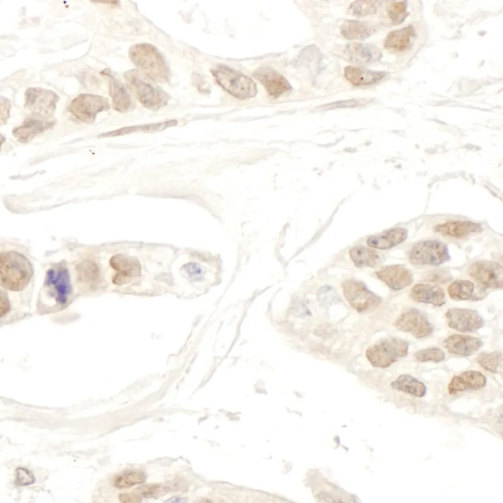 Rabbit anti-RBM34 IHC Antibody, Affinity Purified