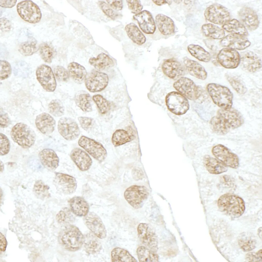 Rabbit anti-POLR3D IHC Antibody, Affinity Purified