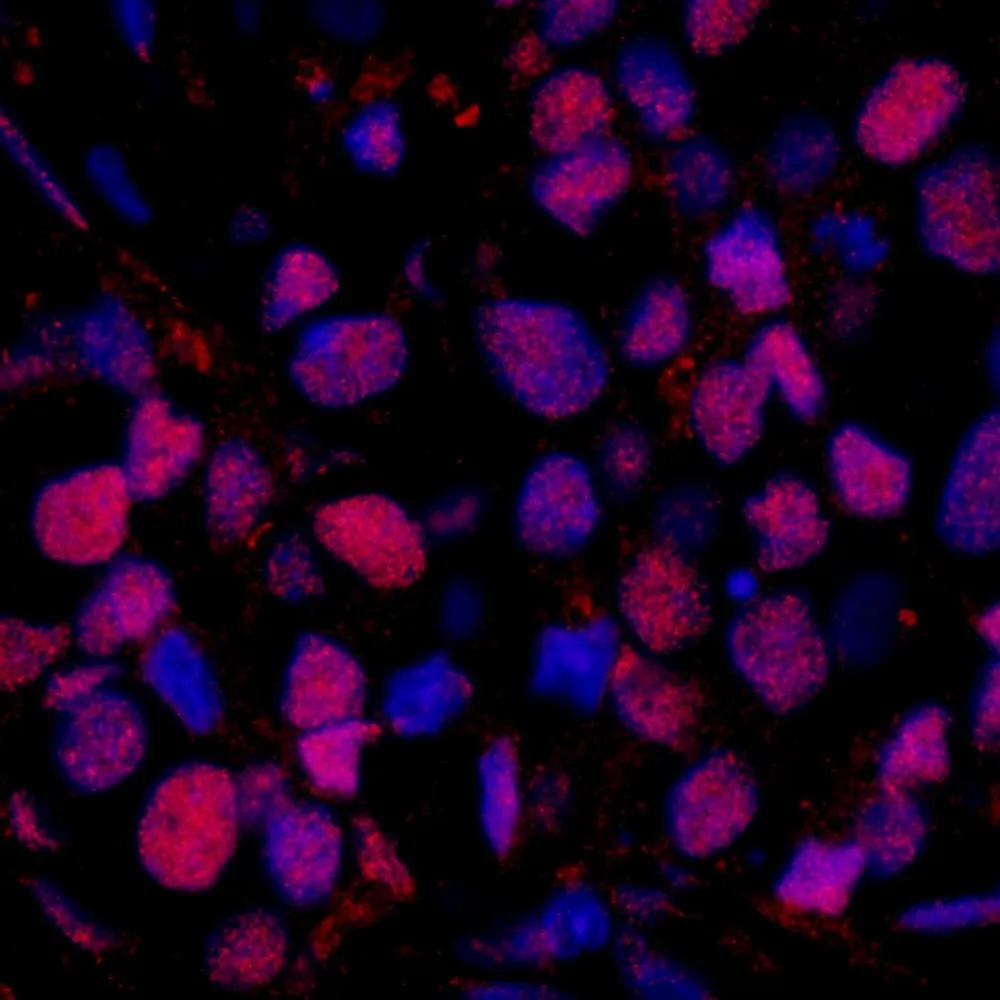 Rabbit anti-RAD23B IHC Antibody, Affinity Purified