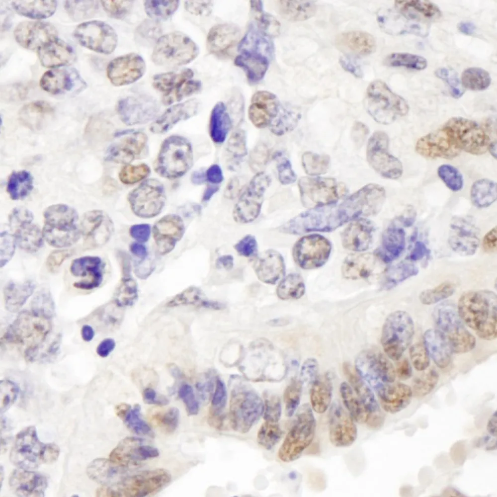 Rabbit anti-p66alpha IHC Antibody, Affinity Purified