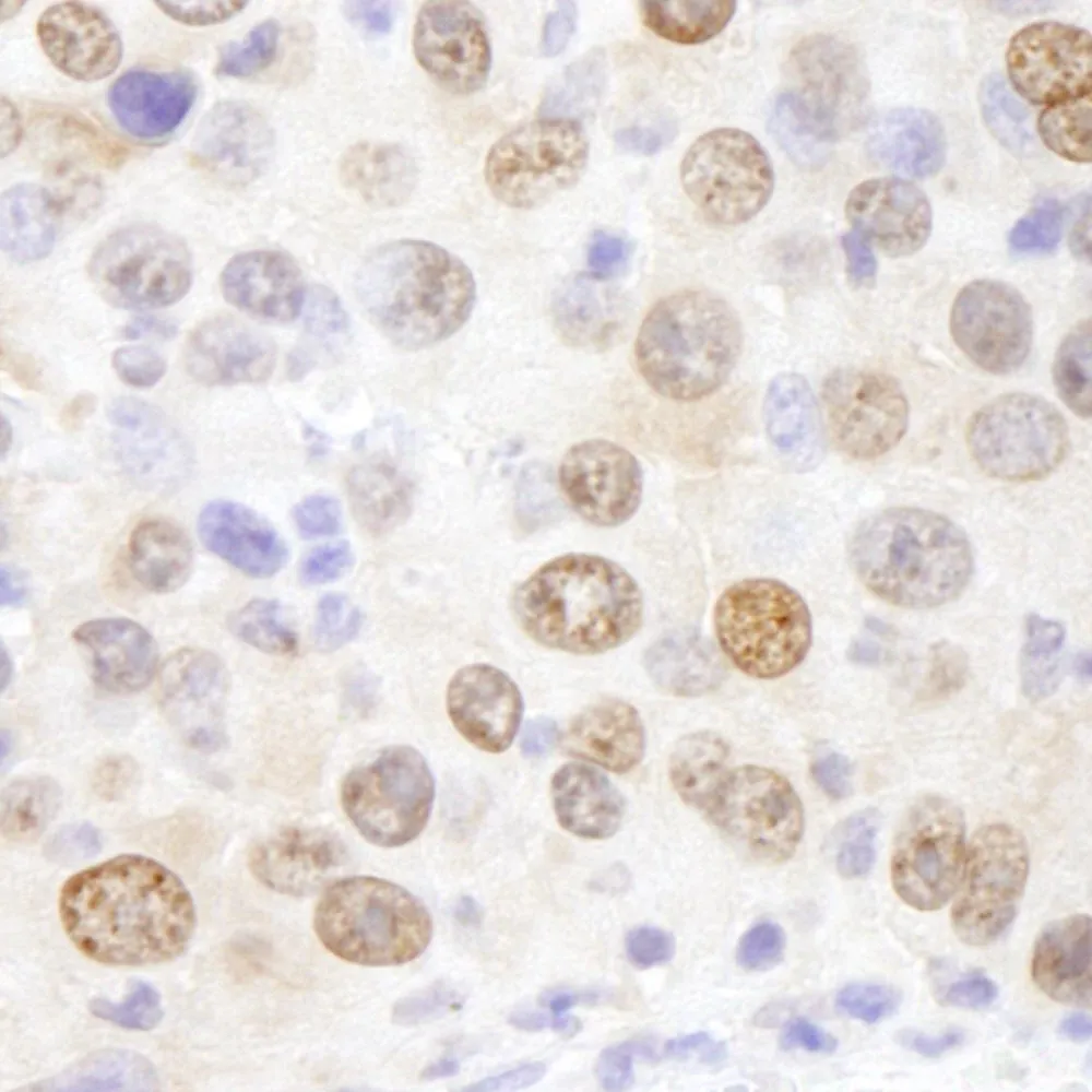 Rabbit anti-HMGN1 IHC Antibody, Affinity Purified