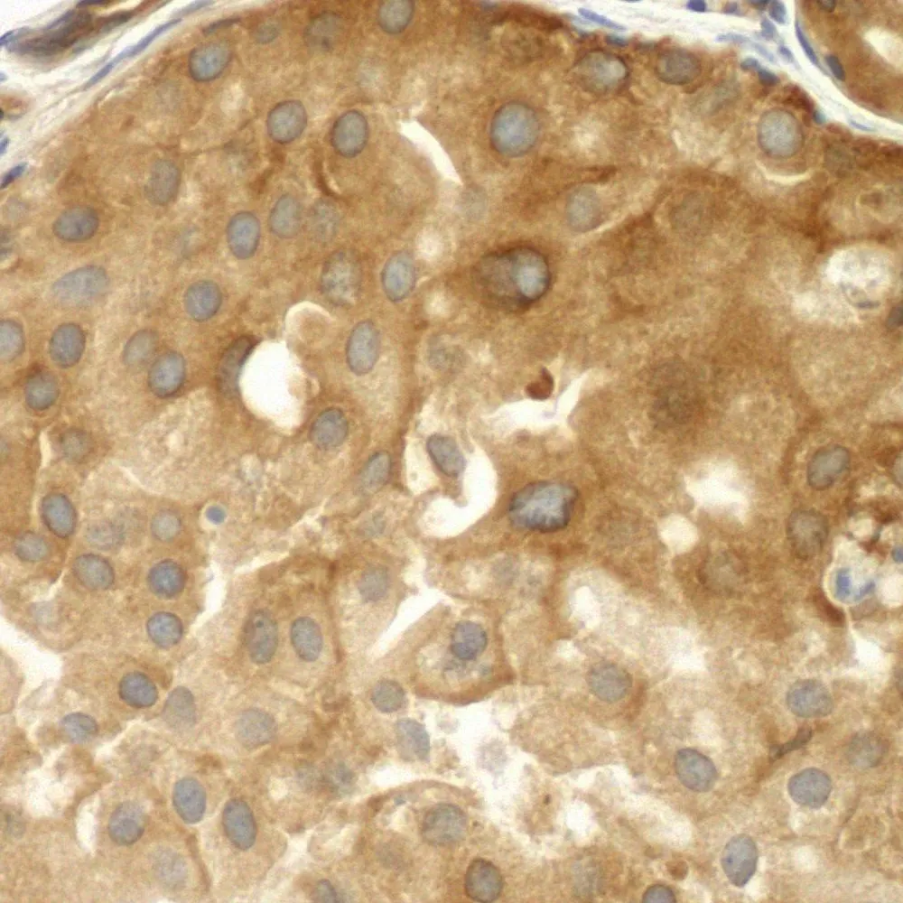 Rabbit anti-Septin 9 IHC Antibody, Affinity Purified