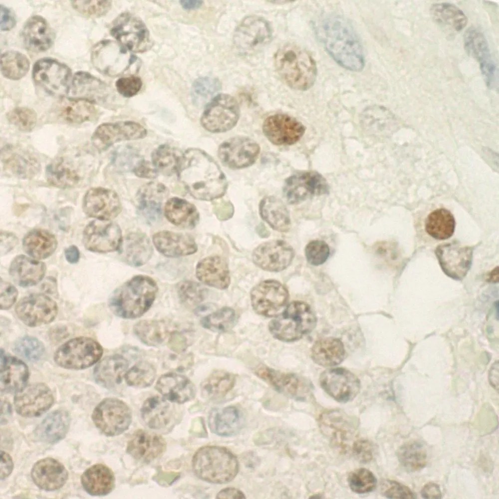 Rabbit anti-PRCC IHC Antibody, Affinity Purified