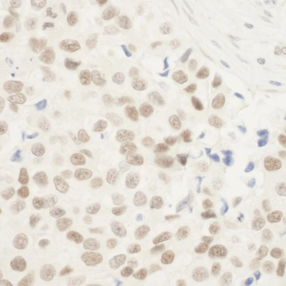 Rabbit anti-ZNF768 IHC Antibody, Affinity Purified