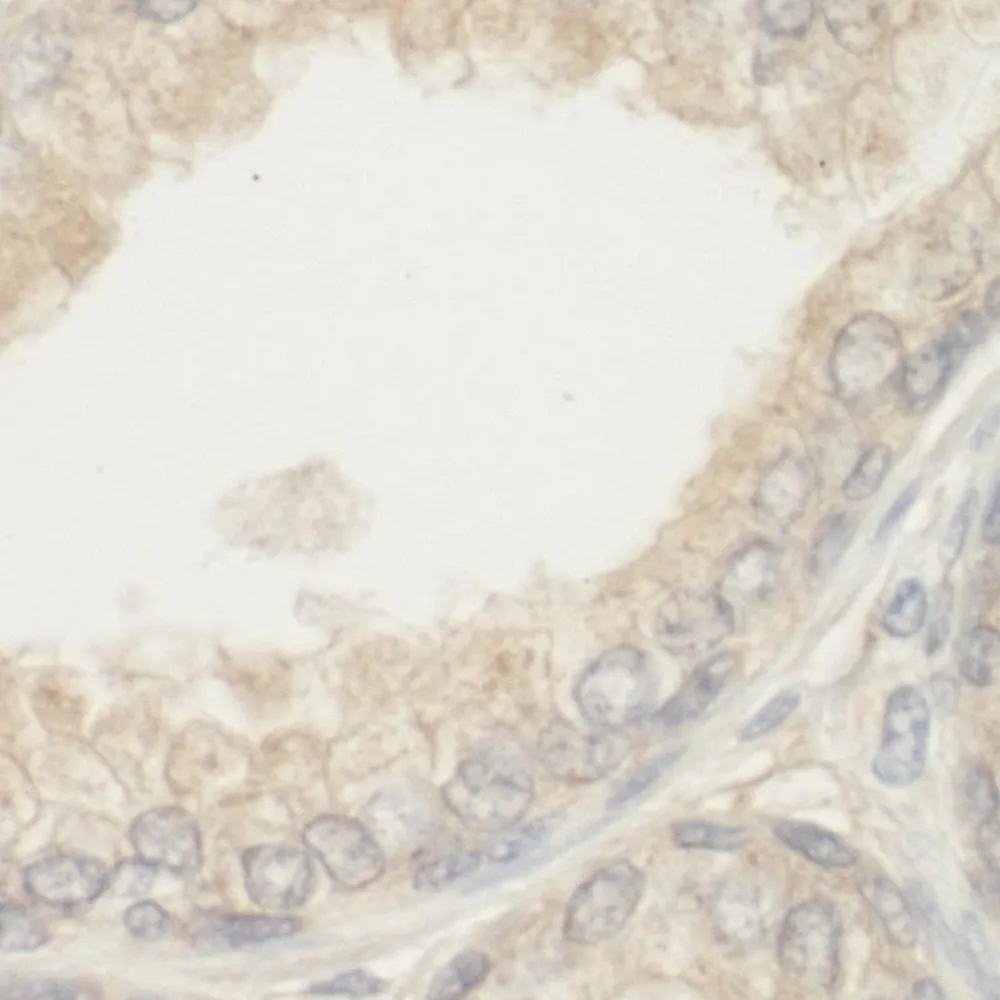 Rabbit anti-BAD IHC Antibody, Affinity Purified