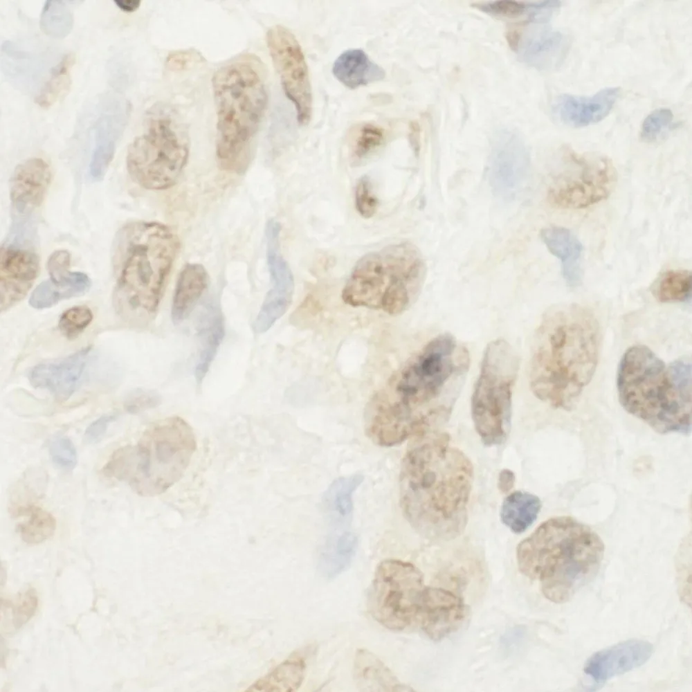 Rabbit anti-BHD IHC Antibody, Affinity Purified