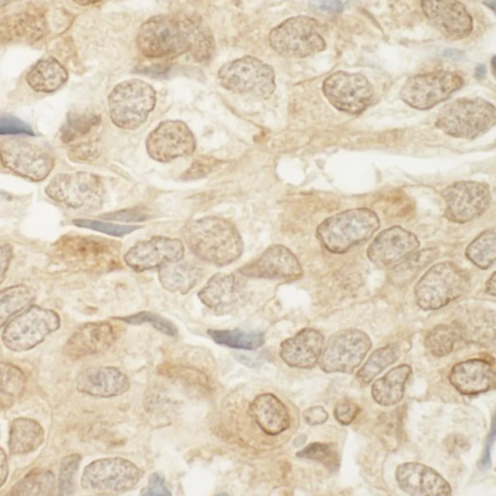 Rabbit anti-MED15 IHC Antibody, Affinity Purified