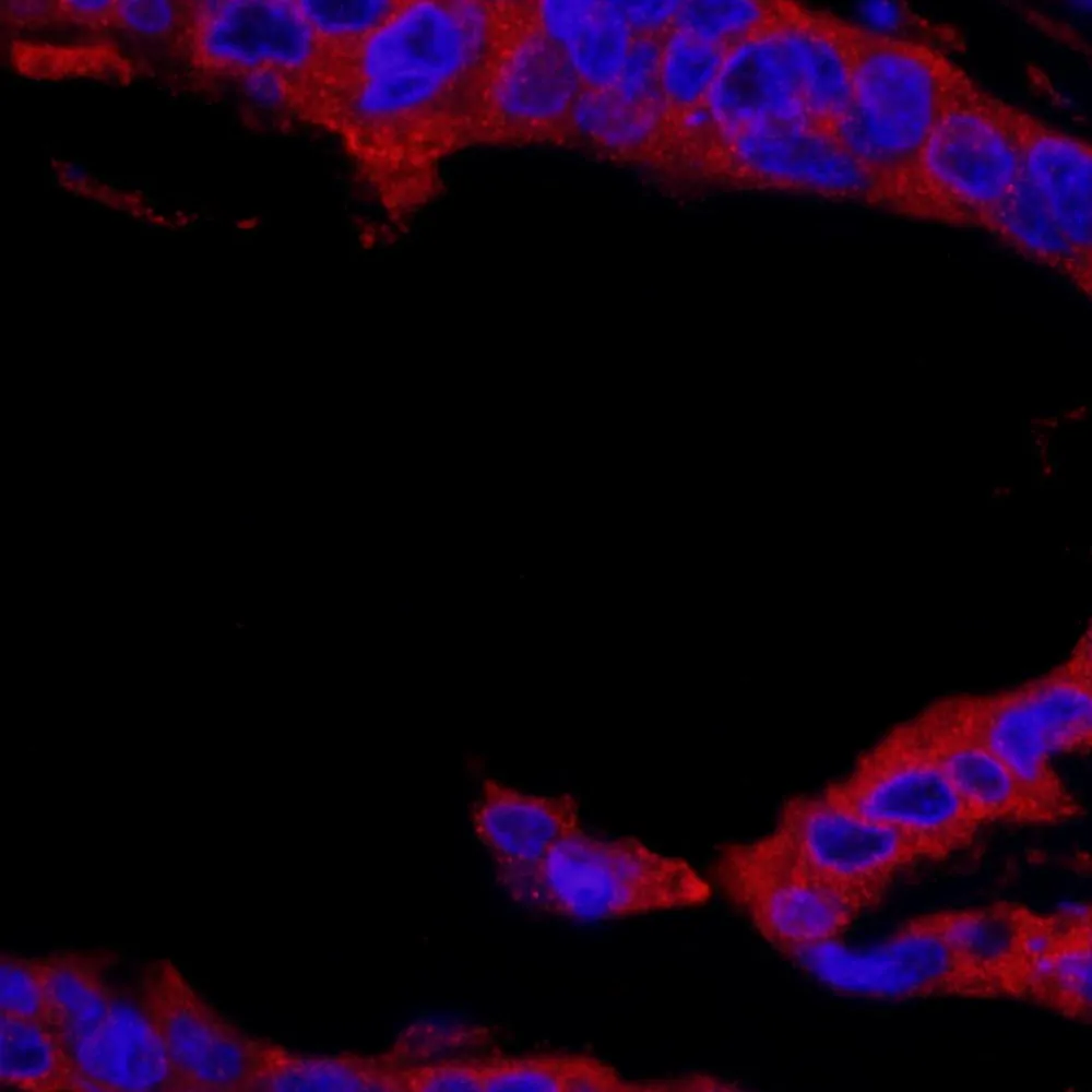 Rabbit anti-RSK1 IHC Antibody, Affinity Purified