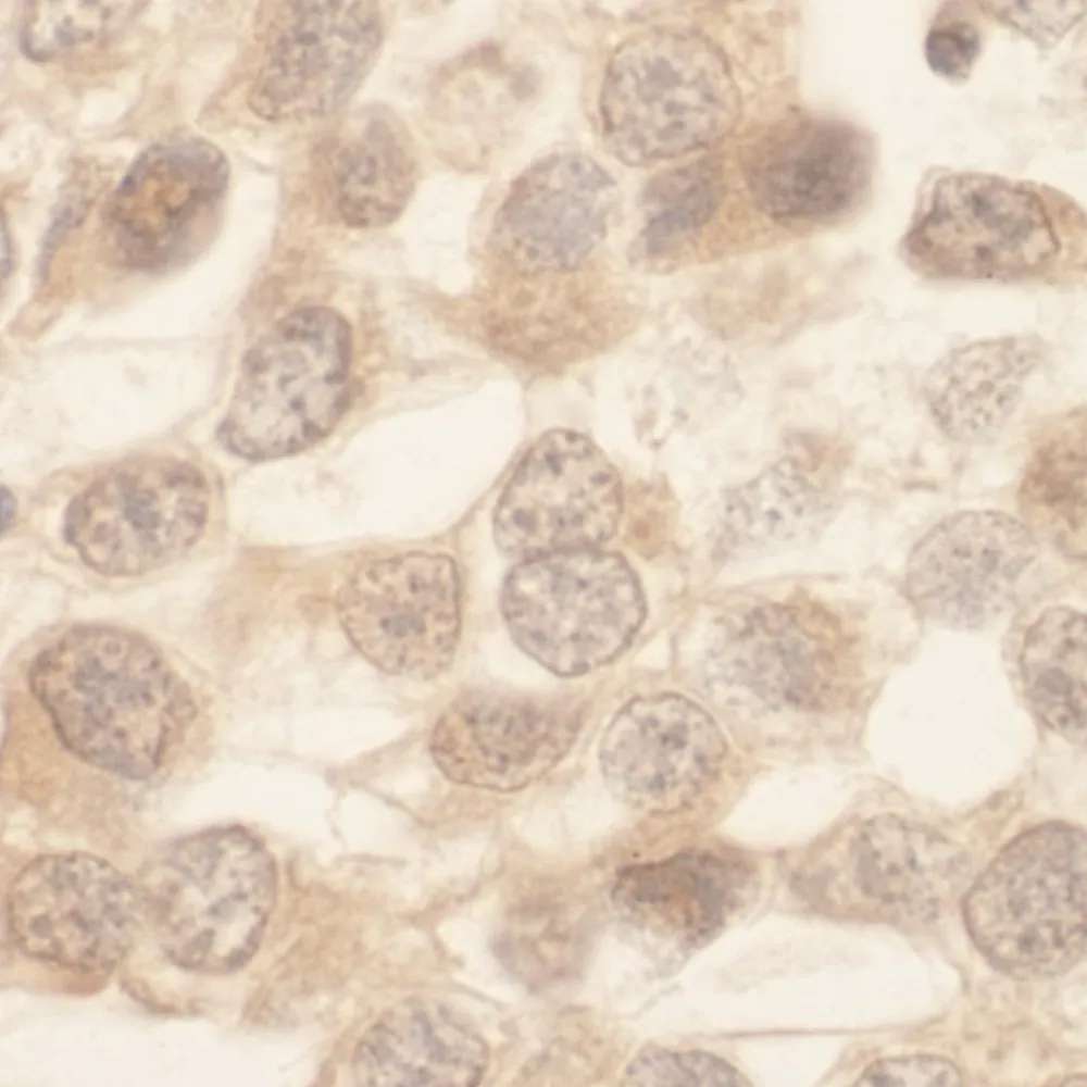 Rabbit anti-SRPK1 IHC Antibody, Affinity Purified
