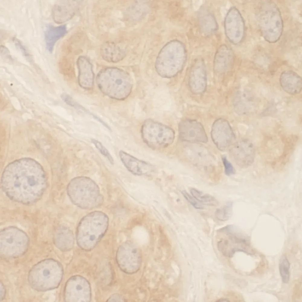 Rabbit anti-SRPK2 IHC Antibody, Affinity Purified