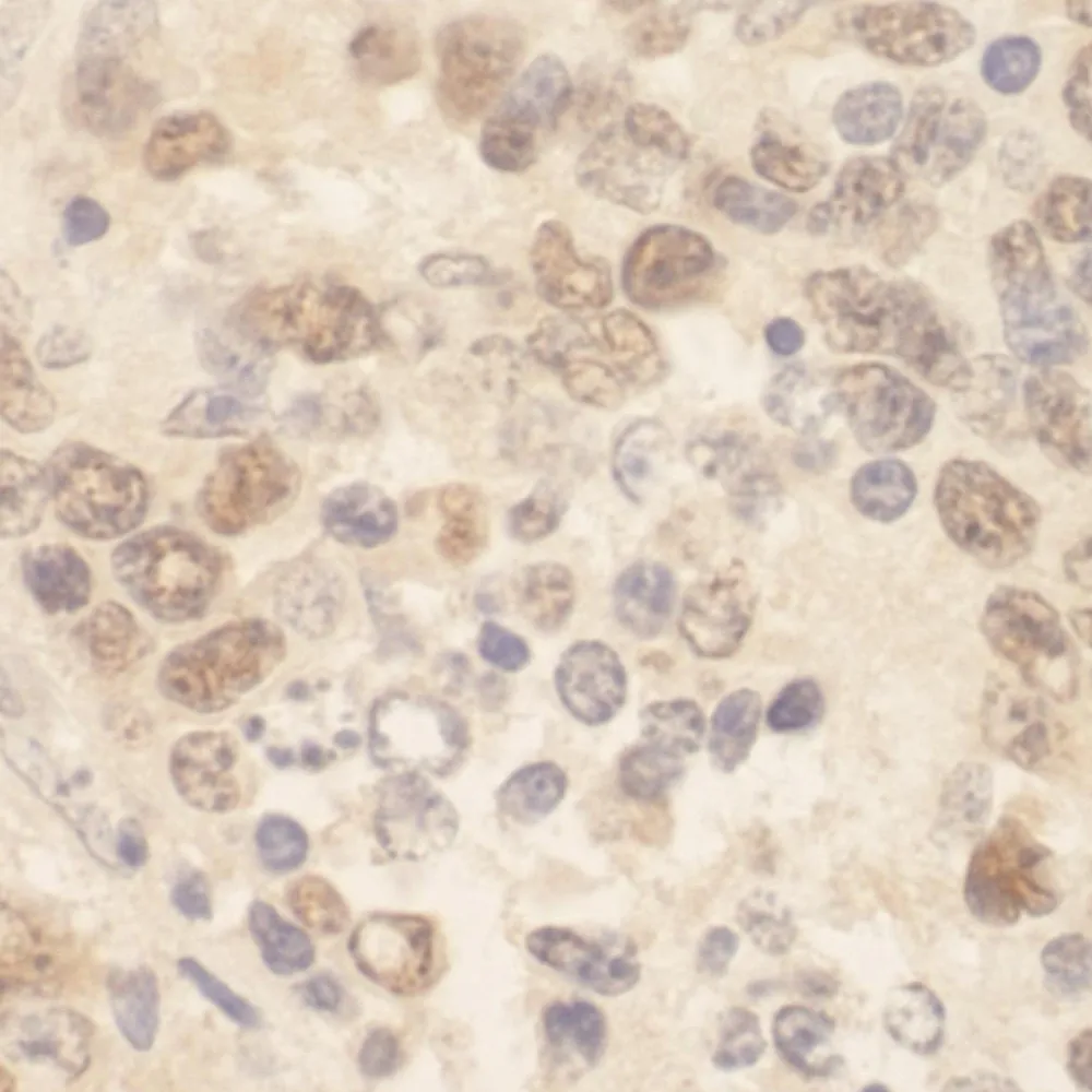 Rabbit anti-ZEB2/SIP IHC Antibody, Affinity Purified