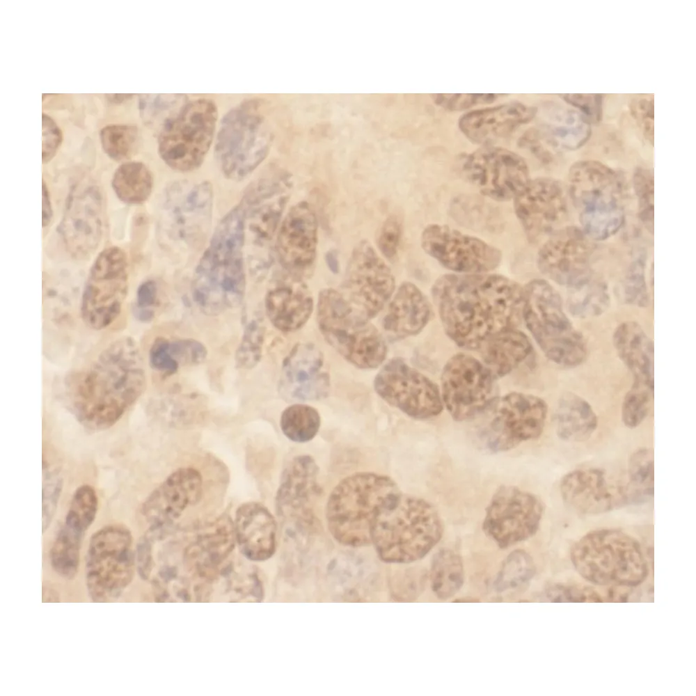 Rabbit anti-Cul2 IHC Antibody, Affinity Purified