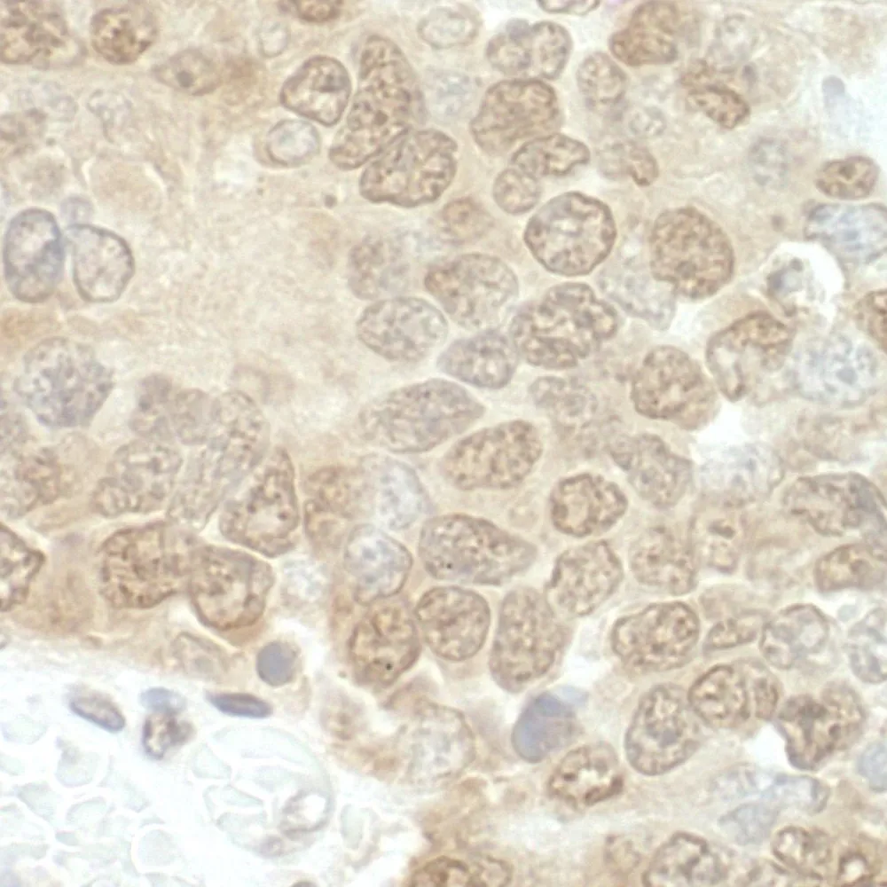 Rabbit anti-RuvBL2 IHC Antibody, Affinity Purified