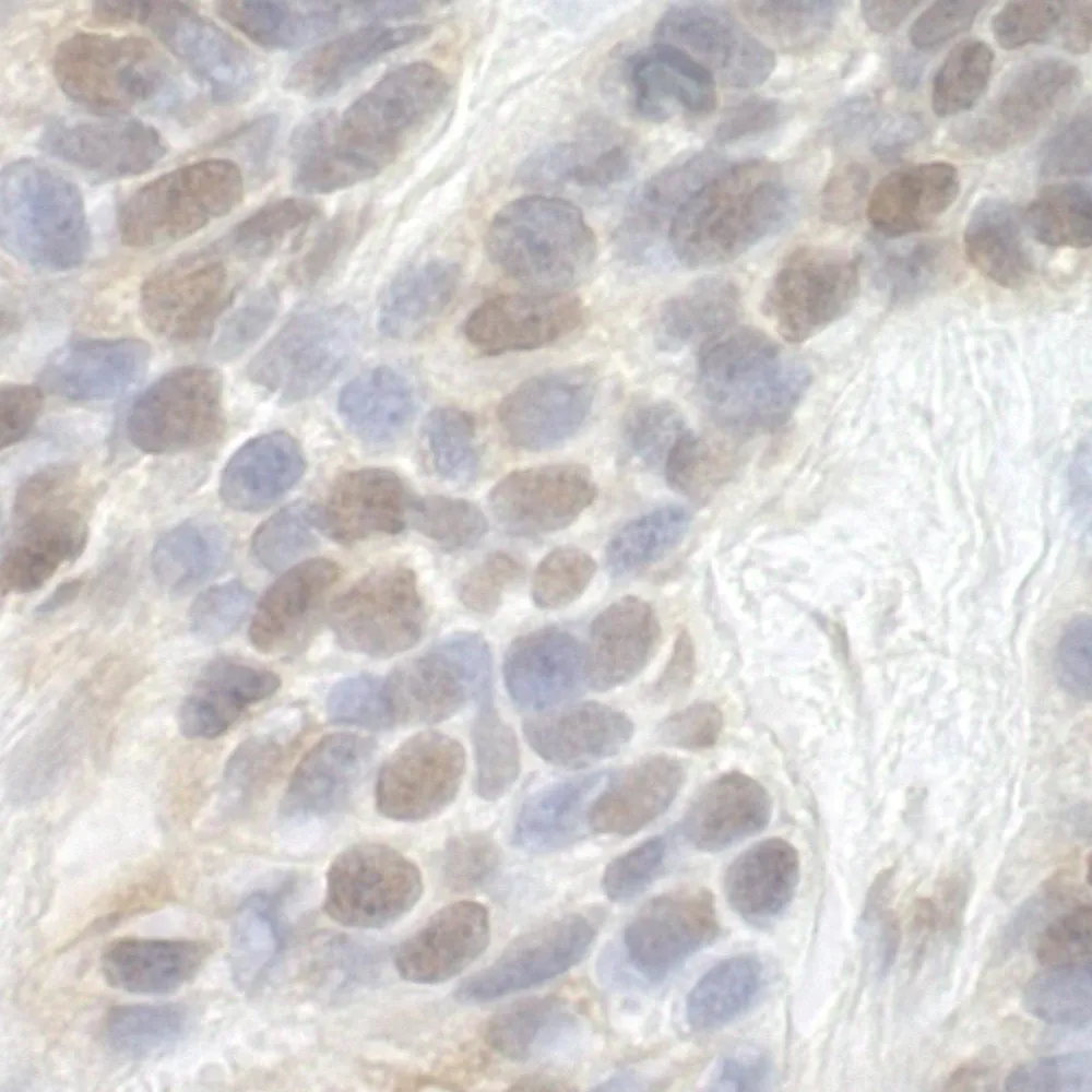 Rabbit anti-CDK8 IHC Antibody, Affinity Purified