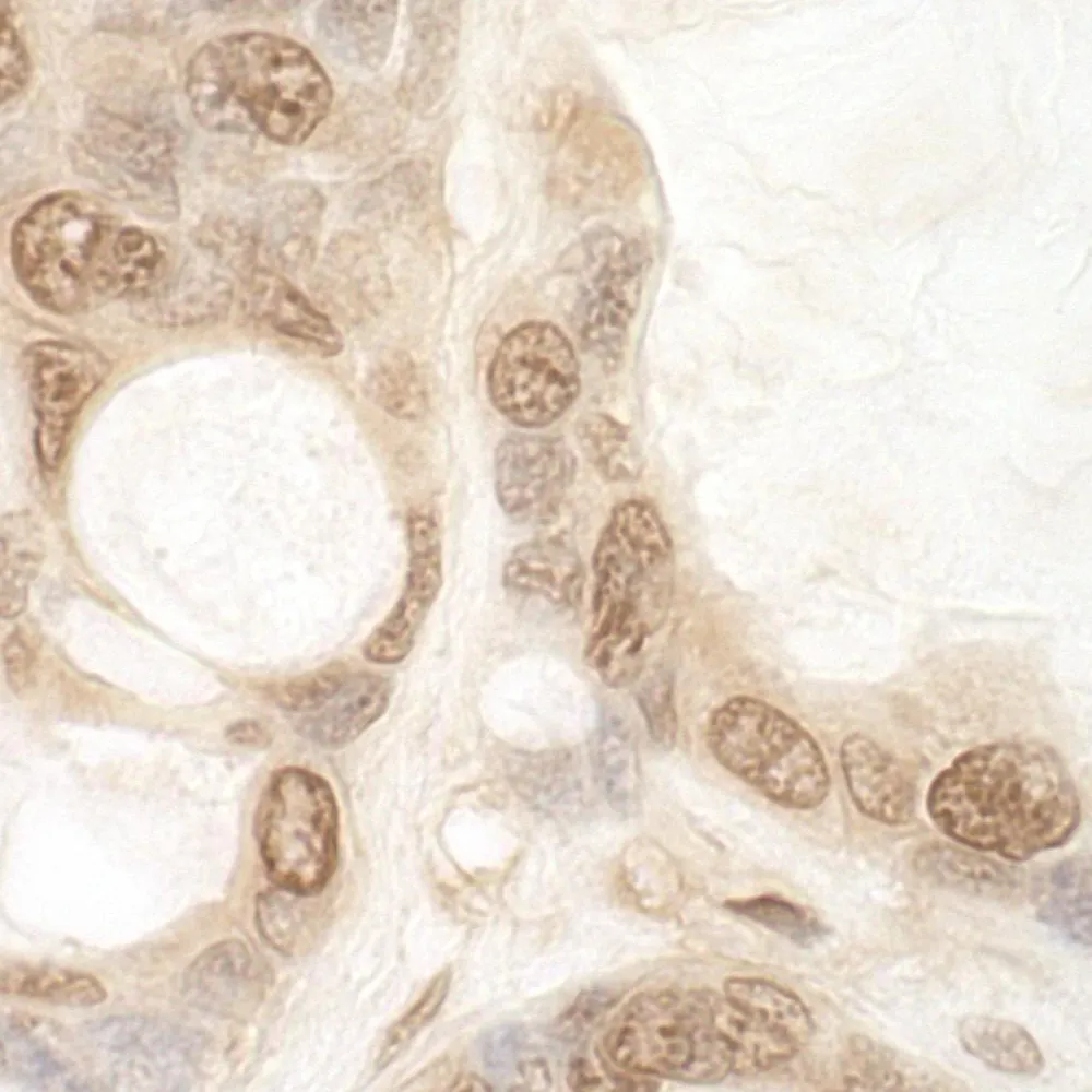 Rabbit anti-eIF2B5 IHC Antibody, Affinity Purified