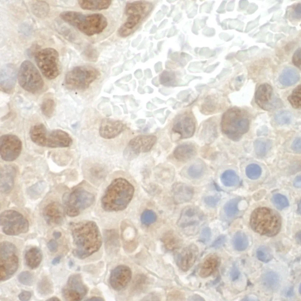 Rabbit anti-POGZ IHC Antibody, Affinity Purified