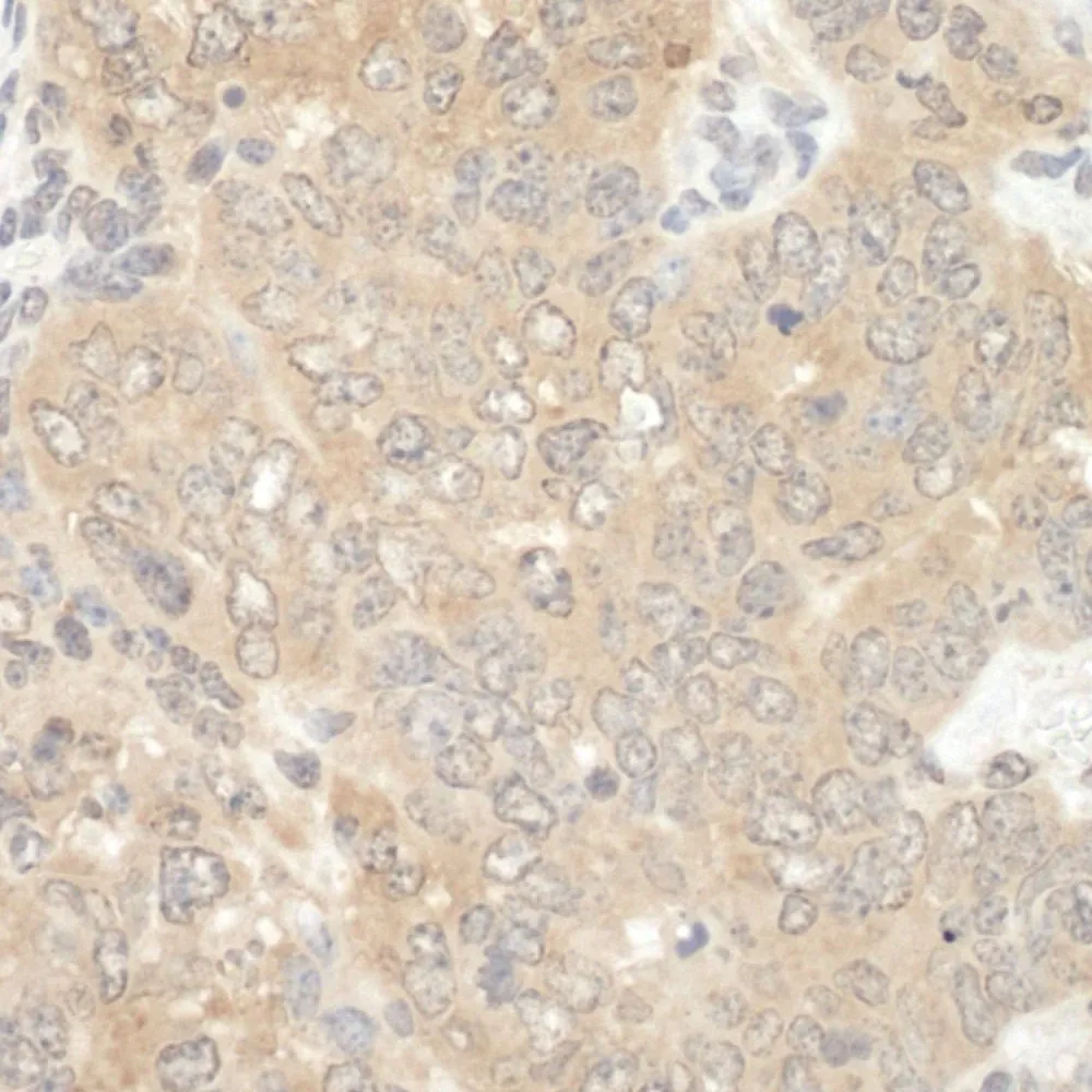 Rabbit anti-NEDD4L IHC Antibody, Affinity Purified