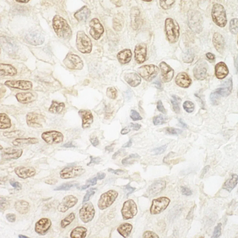 Rabbit anti-ARID3B IHC Antibody, Affinity Purified